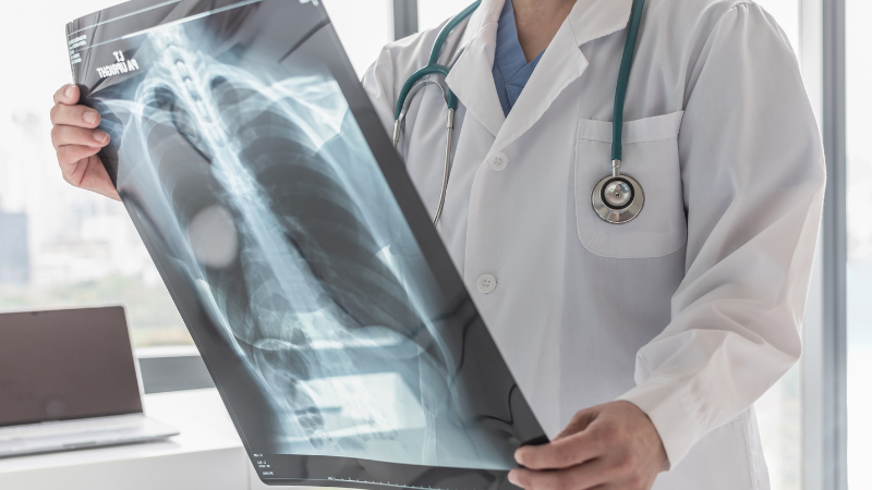 Doctor with radiological chest x-ray film for medical diagnosis on patient's health on asthma, lung disease and cancer illness